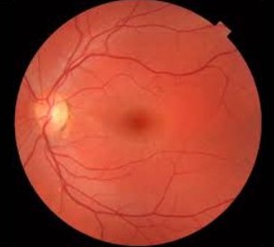 Fundus image example