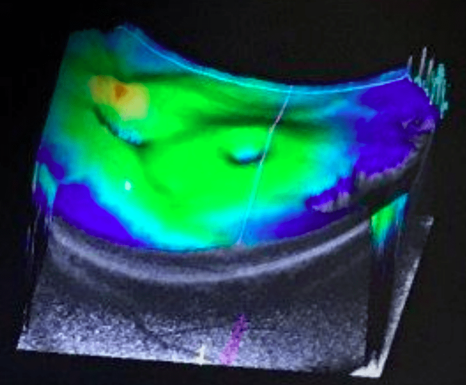 OCT scan analysis